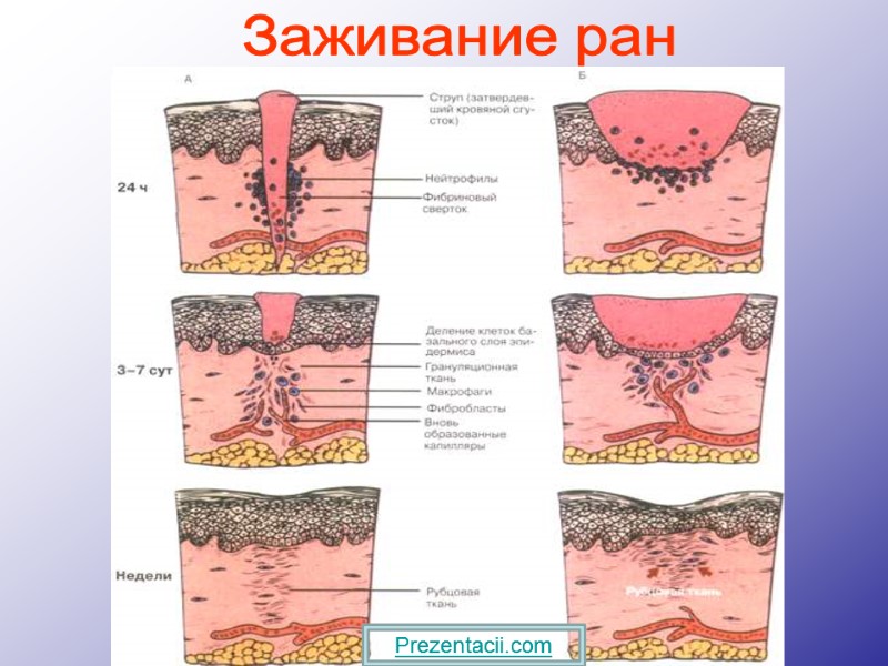 Заживание ран Prezentacii.com